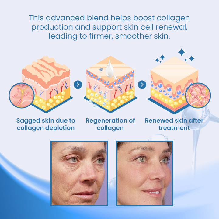 Ceoerty® BotoxPLUS Retinol Eye Cream - ⚕️Dermatologist Recommended (Eye Cream for Fine Lines, Wrinkles, Dark Circles, Dark Spots, and Daily Anti-Aging)