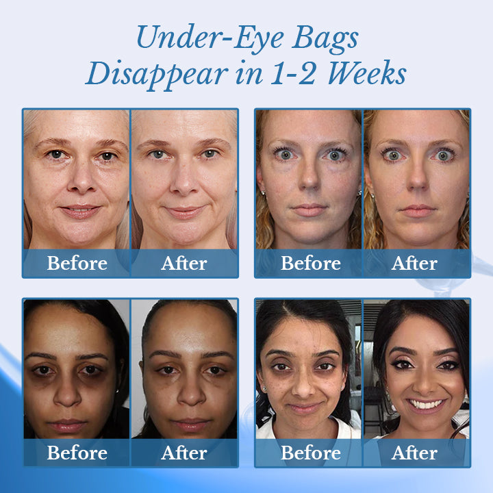 Ceoerty® BotoxPLUS Retinol Eye Cream - ⚕️Dermatologist Recommended (Eye Cream for Fine Lines, Wrinkles, Dark Circles, Dark Spots, and Daily Anti-Aging)