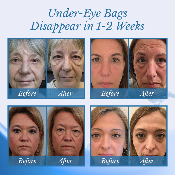 Ceoerty® BotoxPLUS Retinol Eye Cream - ⚕️Dermatologist Recommended (Eye Cream for Fine Lines, Wrinkles, Dark Circles, Dark Spots, and Daily Anti-Aging)