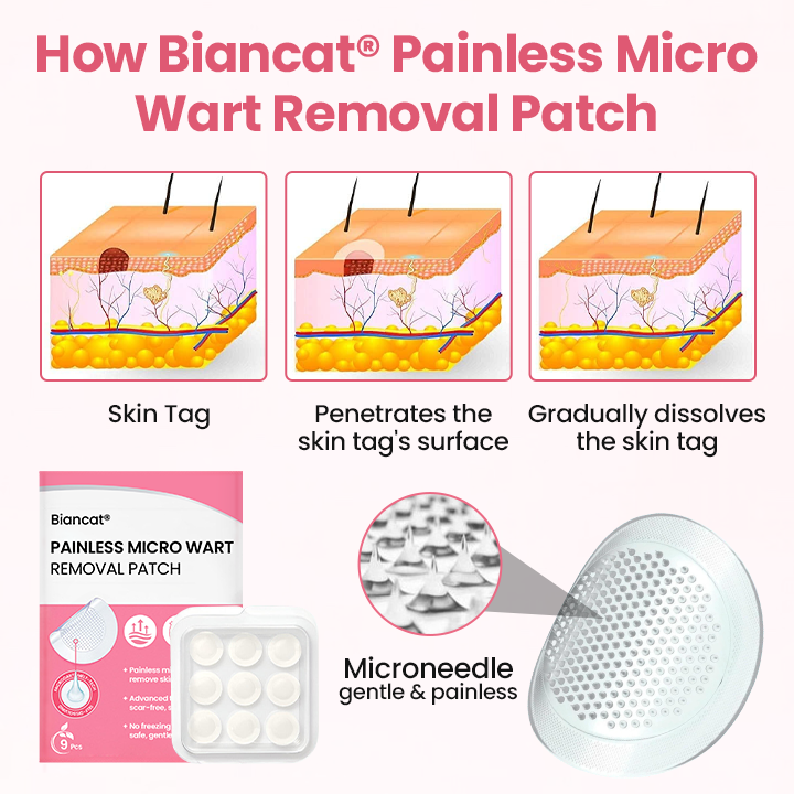 Biancat® Painless Micro Wart Removal Patch