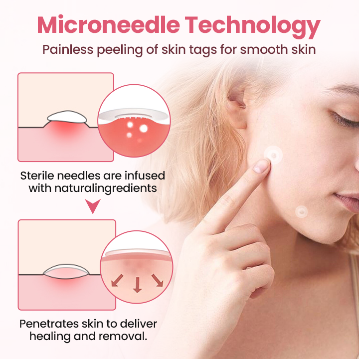 Biancat® Painless Micro Wart Removal Patch