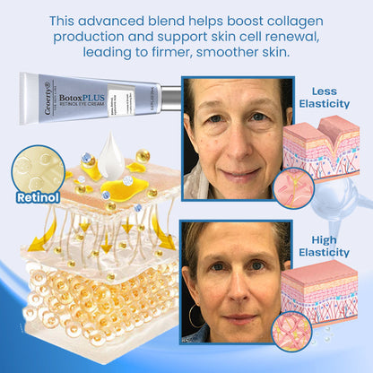 Ceoerty® BotoxPLUS Retinol Eye Cream - ⚕️Dermatologist Recommended (Eye Cream for Fine Lines, Wrinkles, Dark Circles, Dark Spots, and Daily Anti-Aging)
