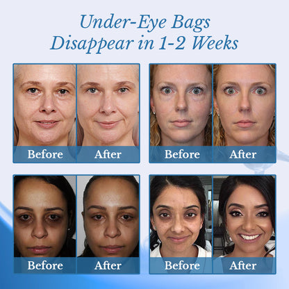 Ceoerty® BotoxPLUS Retinol Eye Cream - ⚕️Dermatologist Recommended (Eye Cream for Fine Lines, Wrinkles, Dark Circles, Dark Spots, and Daily Anti-Aging)