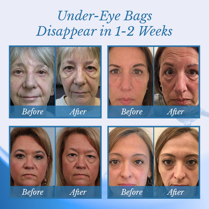 Ceoerty® BotoxPLUS Retinol Eye Cream - ⚕️Dermatologist Recommended (Eye Cream for Fine Lines, Wrinkles, Dark Circles, Dark Spots, and Daily Anti-Aging)