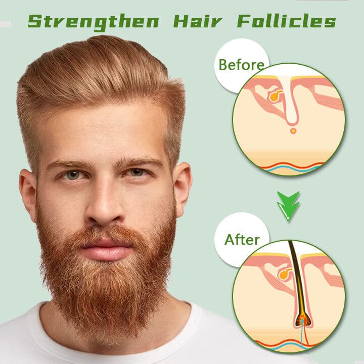 Biancat™ Red Ginseng Hair Regrowth Spray